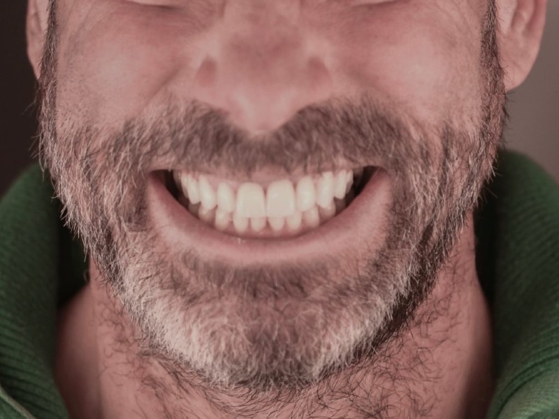 denti dopo cure dentali olgiati busto arsizio