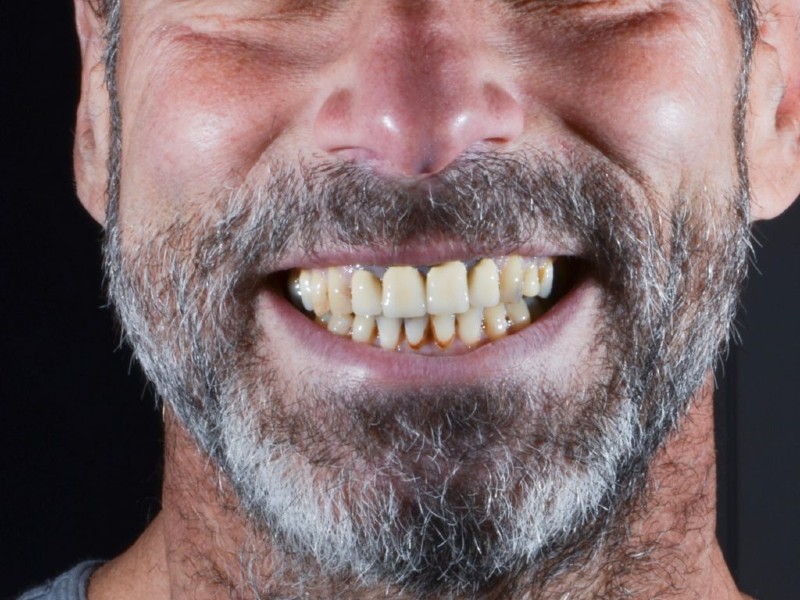 denti prima cure dentali olgiati busto arsizio
