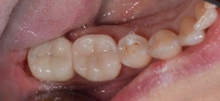 risultato denti terapia conservativa busto arsizio