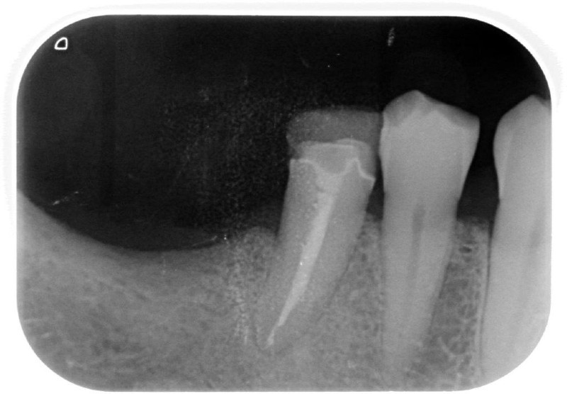 endodonzia prima